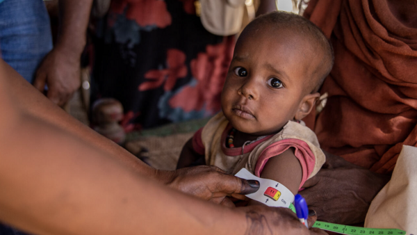 UNICEF-supported health volunteers screen children for malnutrition and provide vitamin A and deworming tablets during a UNICEF-supported door-to-door nutrition campaign in Aroma locality, Kassala state, Sudan.