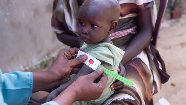 On Sept. 17, 2024, 14-month-old Ismail is screened for malnutrition at UNICEF-supported Elhmedia health center in Rokoro, Central Darfur, Sudan.