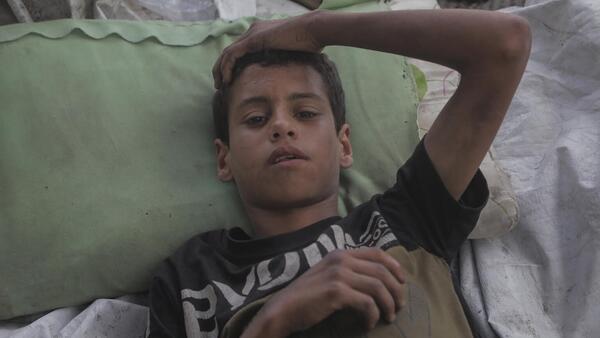 An injured boy lies with his head on a pillow in the Gaza Strip.