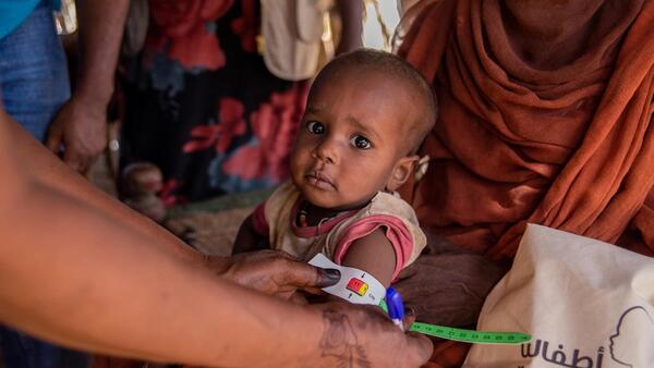 for malnutrition during a UNICEF-supported door-to-door nutrition campaign in Aroma locality, Kassala state, Sudan.