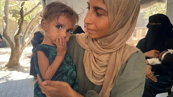A mother holds her malnourished 14-month-old daughter in the Gaza Strip.
