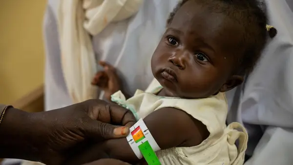  A nutritionist screens one-year-old Humeira for malnutrition and provides care and treatment at Alenaz primary health care center in Al Jazirah State, Sudan. 