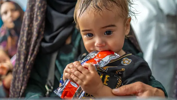 Aref, a one-year-old from Herat, Afghanistan, is undergoing a health and nutrition assessment and receiving a further supply of ready-to-use therapeutic food (RUTF) from UNICEF to treat malnutrition. 