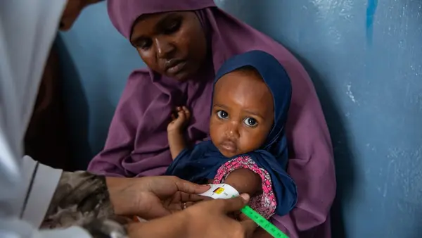 A UNICEF-supported health worker measures the mid-upper arm of a baby during a malnutrition screening in Mogadishu, Somalia on Aug. 17, 2026