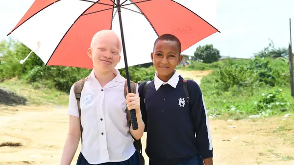 12-year-old girl from Côte d'Ivoire with albinism, with her friend.