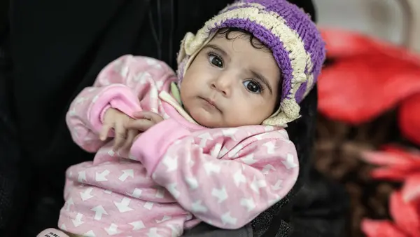 Ethar, 4 months old, is recovering from malnutrition at a UNICEF-supported hospital in Sana'a, Yemen. 