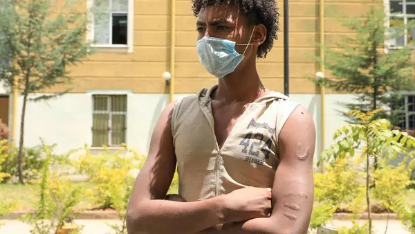 UNICEF helps unaccompanied child migrants like Berhan, 17, who left Ethiopia to find work but was captured by human traffickers in Yemen and held captive for five months. 
