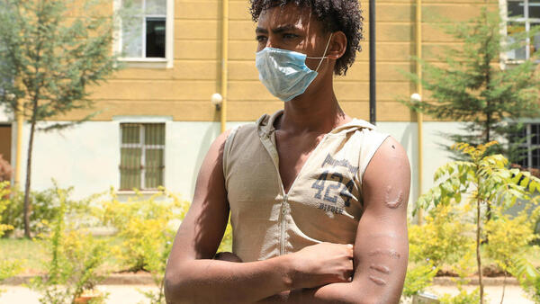 UNICEF helps unaccompanied child migrants like Berhan, 17, who left Ethiopia to find work but was captured by human traffickers in Yemen and held captive for five months. 