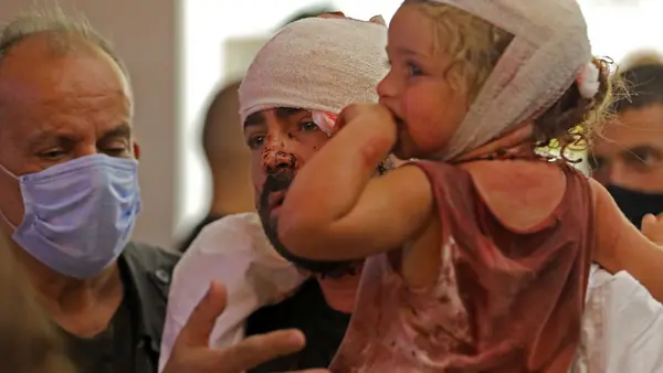 Wounded people are treated at a hospital following an explosion near the port in the Lebanese capital Beirut on August 4, 2020.