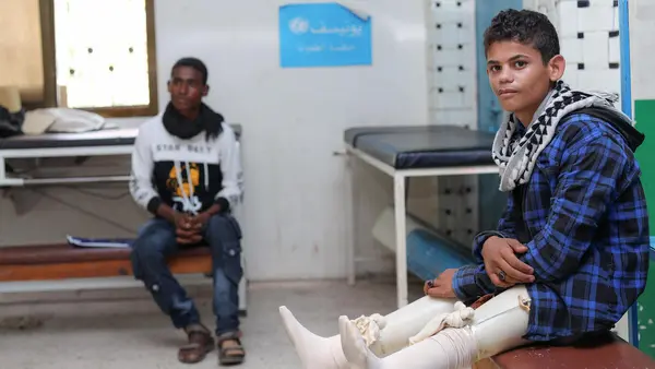 After losing his legs in a landmine explosion, Ibrahim, 17, received artificial limbs and learned to walk again at a UNICEF-supported prosthetic center in Aden, Yemen.