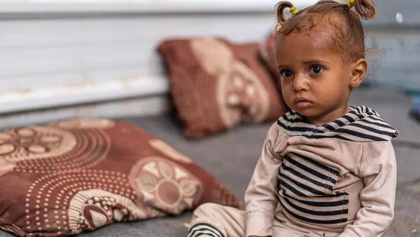 One-year-old Ghosson was treated for severe acute malnutrition at UNICEF-supported Al Sadaqa Hospital in Aden, Yemen in 2021.