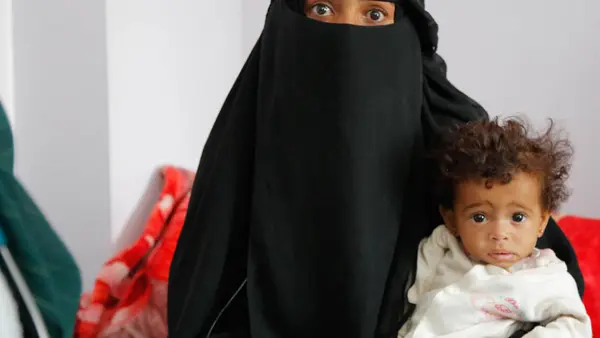 Maryam holds her 9-month-old daughter, Anisa, who is being treated for severe acute malnutrition at UNICEF-supported Hamdan Hospital, Sana’a, Yemen on October 11, 2021.