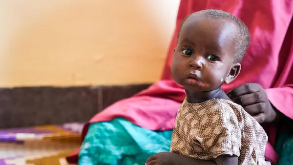 On 25 May 2022, 10-month-old Marwo, who is malnourished, sits with her mother at UNICEF-supported Banadir Hospital in Mogadishu, Somalia.