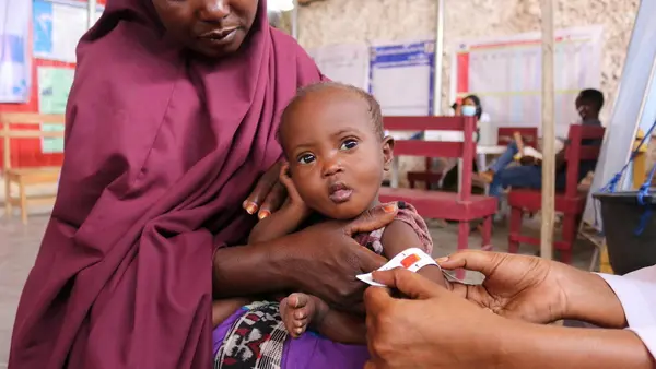 A health worker screens 2-year-old Sabirin for malnutrition at a UNICEF-supported health center outside Mogadishu, Somalia.
