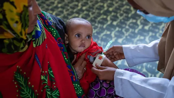 A health care worker screens 8-month-old Latu to measure the progress of her treatment for severe acute malnutrition at the UNICEF-supported Dubuluk Health Center in Ethiopia.
