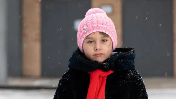 Polina, 7, of Eastern Ukraine bears the scars of injuries she suffered when a shell exploded outside the family home.