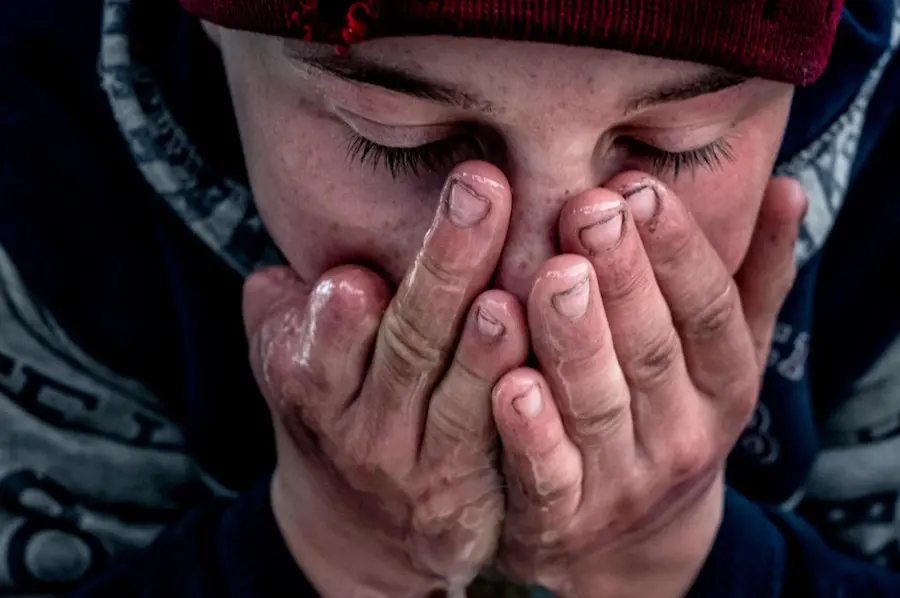 teenage boy applying water to his face with hand missing some fingers