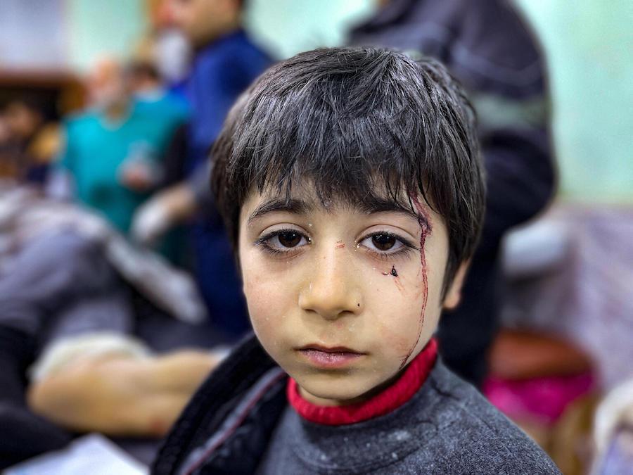 An injured child awaits treatment at a hospital in Syria's Idlib Province following the Feb. 6, 2023 earthquakes.