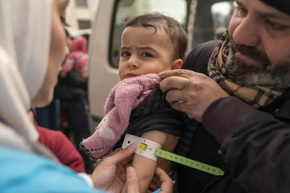 A father holds his 2-year-old as a UNICEF mobile health team member measures the child's mid-upper arm to screen for malnutrition. 