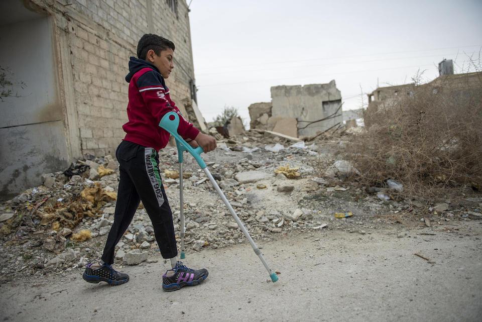 Bashar, 11, practices walking with his new prosthetic legs in Jarba, his home village, in rural Damascus, Syria.