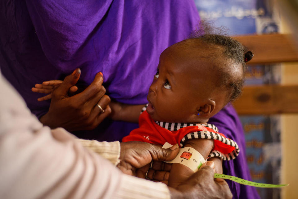 The MUAC tape reading for 1-year-old Mawada shows severe acute malnutrition during a screening at a UNICEF-supported facility in Port Sudan, Sudan.