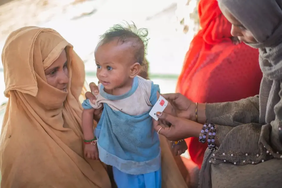 One-year-old Aisha is screened for malnutrition during the mass mid-upper arm circumference (MUAC) screening and referral campaign focused on children under age 5 in River Nile state, Sudan. Aisha has severe acute malnutrition and requires immediate treatment.