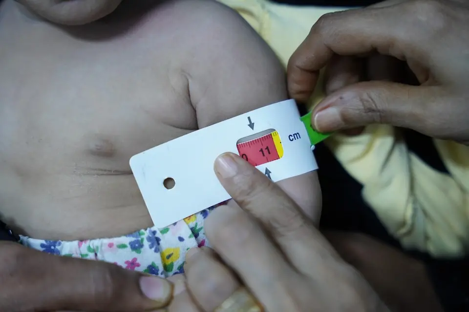 A baby is screened for malnutrition at a UNICEF-supported health center in Aden, Yemen. 