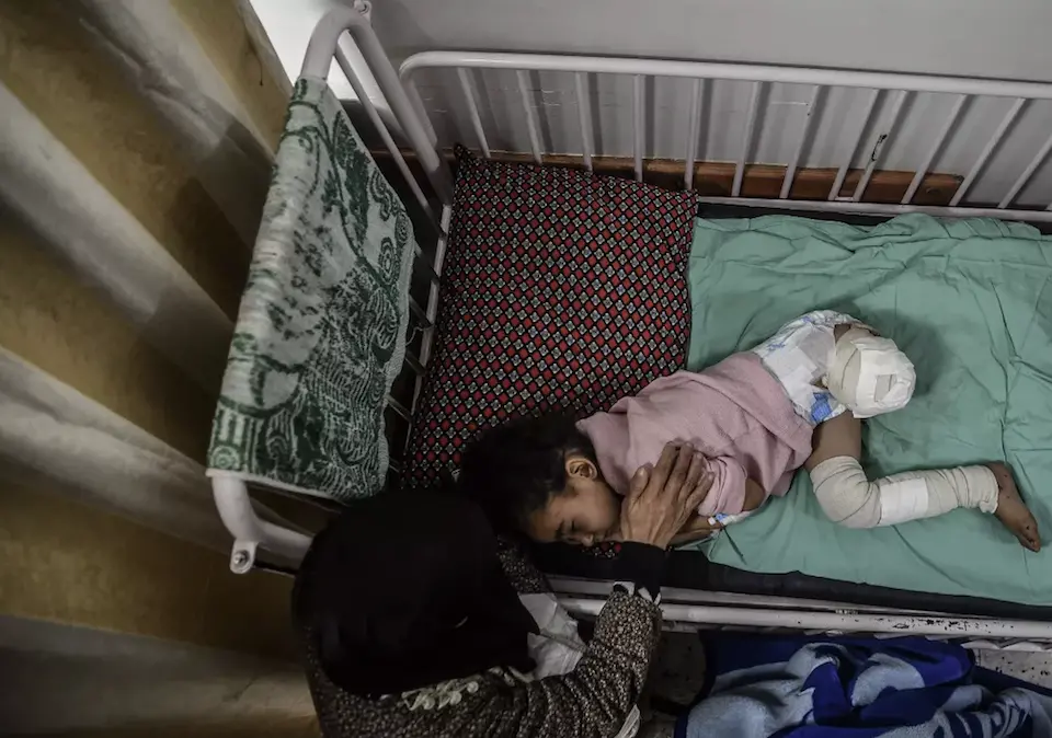 Ghazal, 4, lost her left leg when her house in the Gaza Strip was hit by shelling on Oct. 12, 2023.