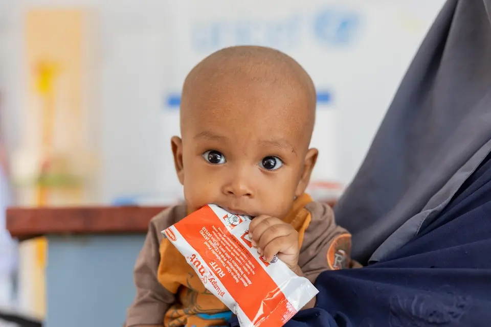 Nine-month-old Omer eats from a packet of ready-to-use therapeutic food at the UNICEF-supported Alkarama clinic in Kassala state, Sudan.