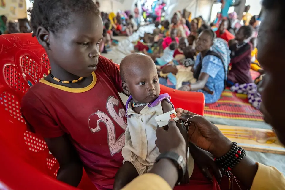 On July 26, 2024, a child whose family fled the conflict in Sudan is screened for malnutrition at a UNICEF-supported clinic in Renk Transit Center in Renk, South Sudan.
