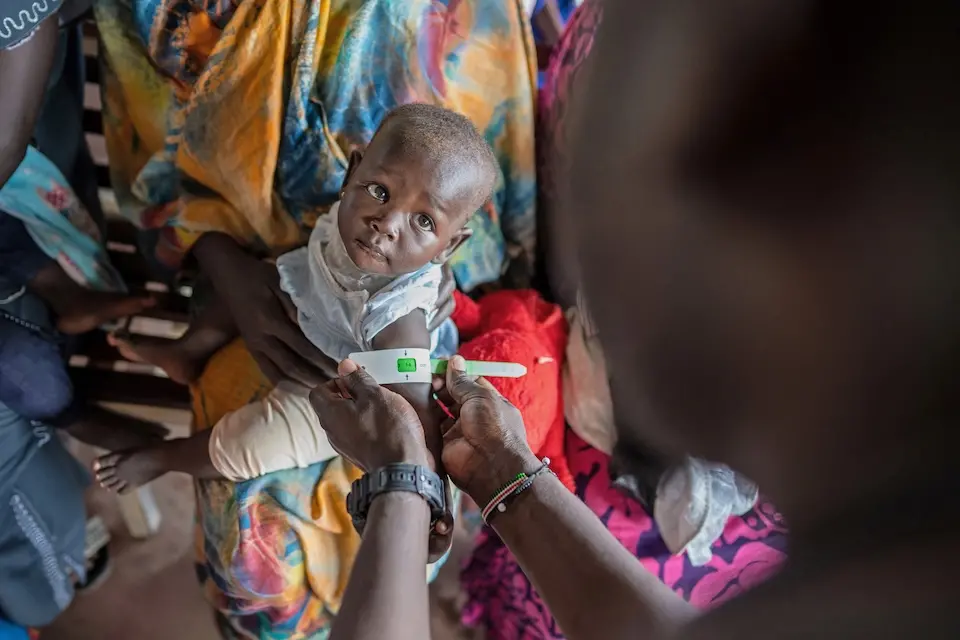 A child is checked for malnutrition at the UNICEF-supported nutrition clinic at Kimu Primary Healthcare Centre in Juba, South Sudan.