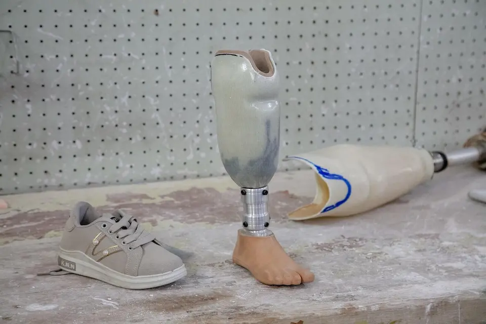Khadija's prosthetic limb at the UNICEF-supported Prosthetic Center in Sana'a, Yemen.