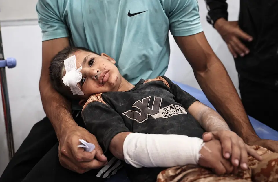 Ayman Abu Hujair, 5, receives treatment at Al-Awda Hospital in Nuseirat camp after an airstrike targeted the Al-Hasayneh School, run by UNRWA and housing displaced Palestinians.