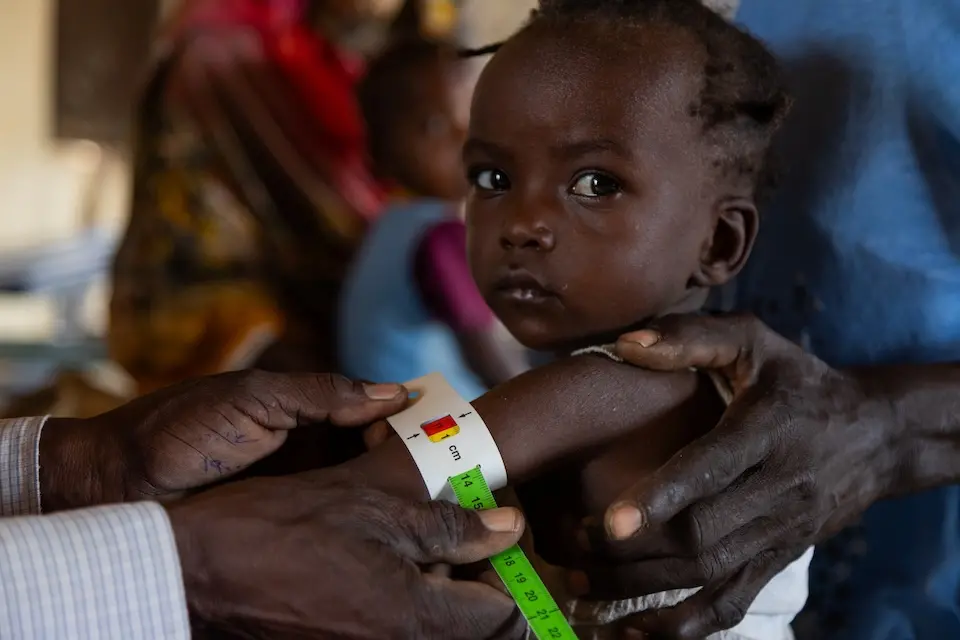 A child's middle upper arm circumference is measured showing acute malnutrition.