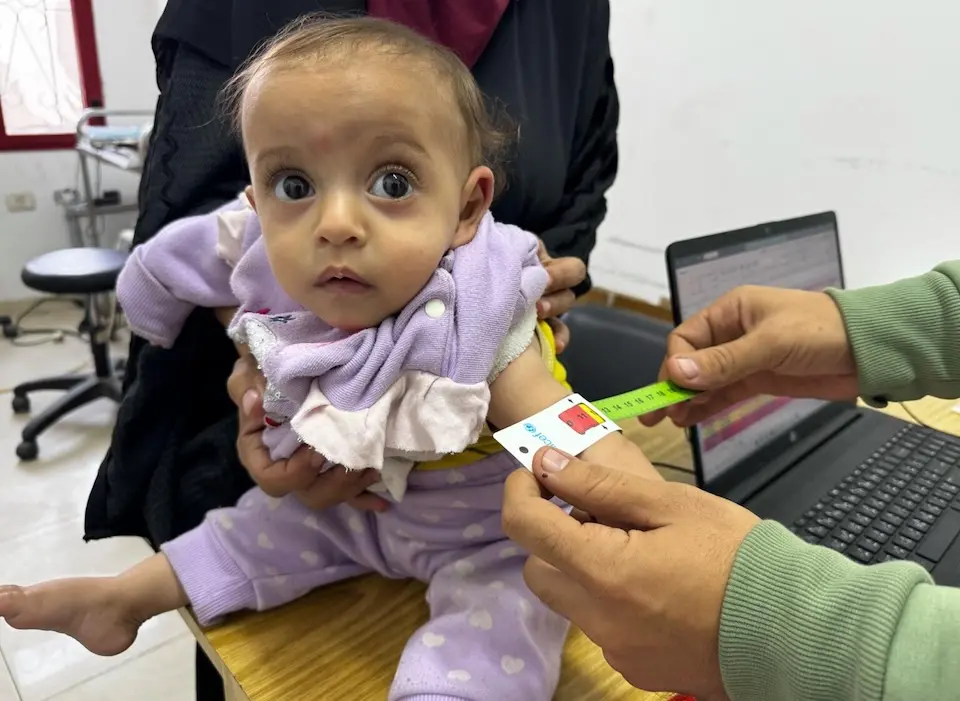 A 10-month-old baby is screened for severe acute malnutrition in the Gaza Strip on Nov. 26, 2025.