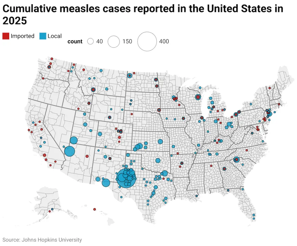 U.S. map showing measles cases in 2025. source: Johns Hopkins University