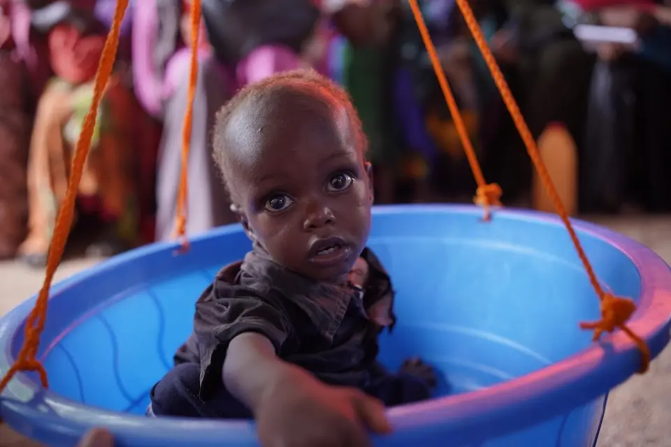 A 2-year-old sits on a scale during a routine nutrition assessment at a UNICEF-supported outpatient center in Burhakaba, Bay region, Somalia. 