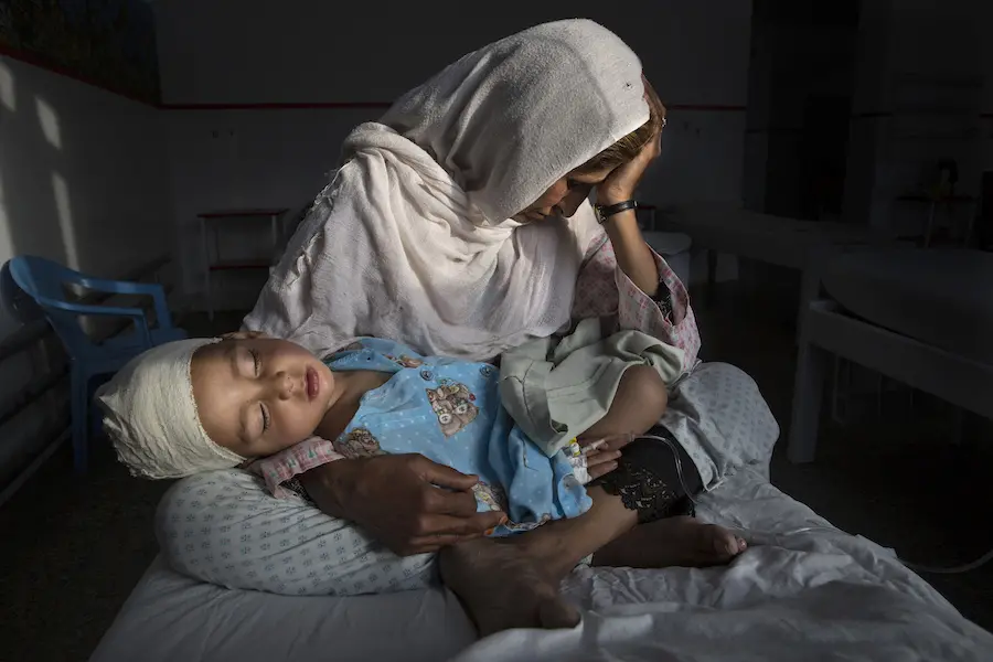 Najiba holds her nephew Shabir, 2, who was injured in a bomb blast that killed his sister, in Kabul, Afghanistan, in March 2019. Najiba holds her nephew Shabir, 2, who was injured in a bomb blast that killed his sister, in Kabul, Afghanistan, in March 2019.
