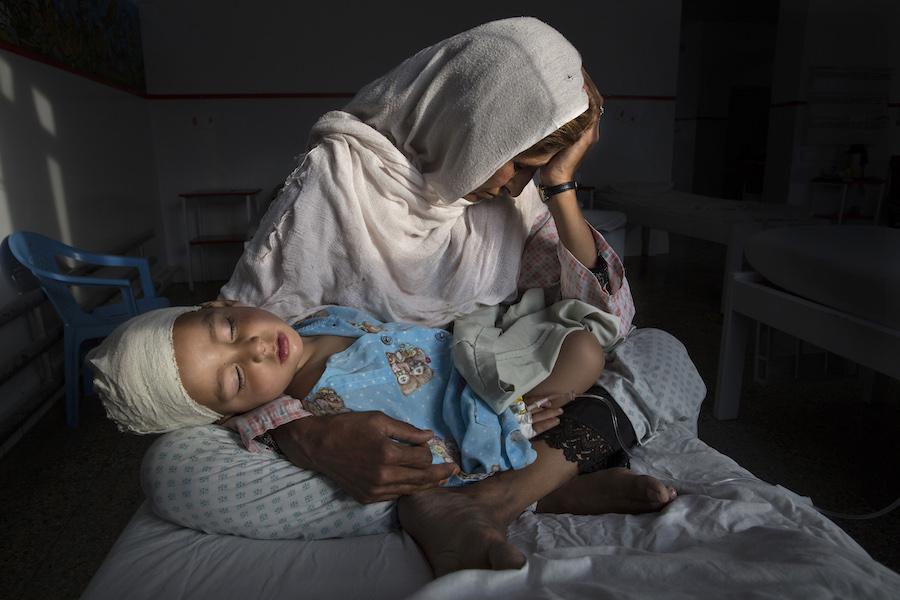 Najiba holds her nephew Shabir, 2, who was injured in a bomb blast that killed his sister, in Kabul, Afghanistan, in March 2019.