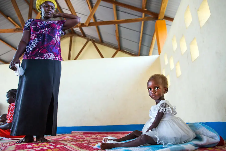 Diagnosed with severe acute malnutrition, two-year-old Maria was treated at a UNICEF-supported health center in Juba, South Sudan in October 2017. Diagnosed with severe acute malnutrition, two-year-old Maria was treated at a UNICEF-supported health center in Juba, South Sudan in October 2017.