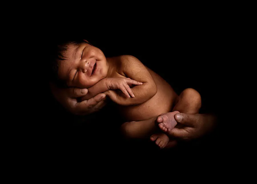 Week-old Priscilla was born via caesarean section in Paruo Province, Peru in February 2018, because her mother suffers from epilepsy. Week-old Priscilla was born via caesarean section in Paruo Province, Peru in February 2018, because her mother suffers from epilepsy.
