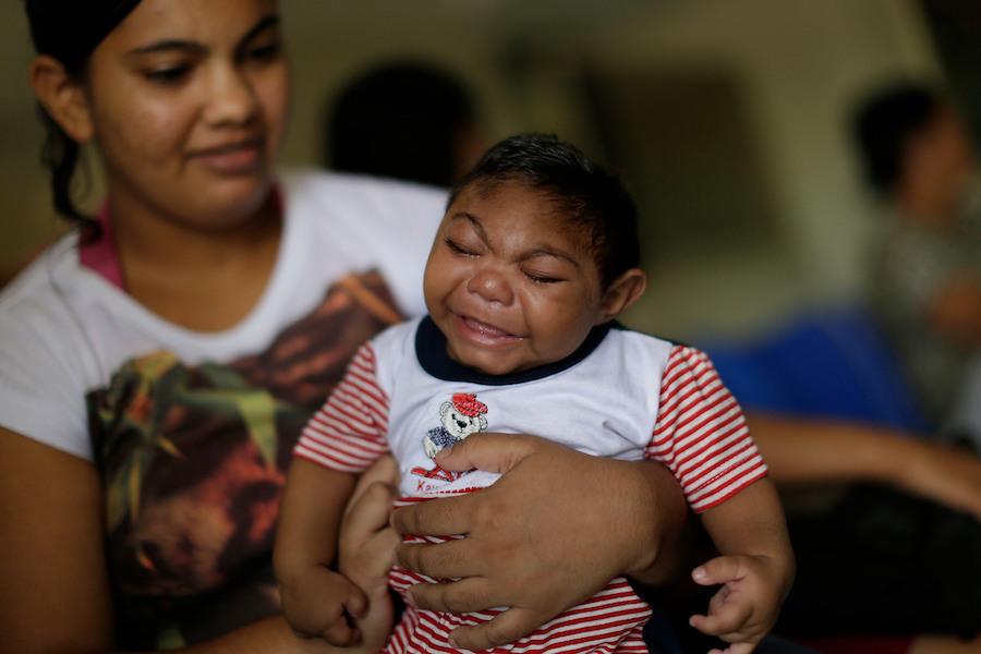 On 23 February 2016, Danielle Lira, 19 years-old, mother of Thalles, who was born with microcephaly in Recife, Brazil. UNICEF 2016 ZIKA