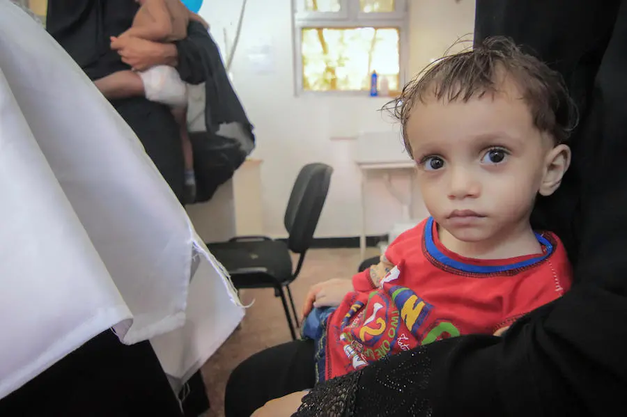 In June 2018, a small child is treated at the UNICEF-supported Alqatee'a Health Center in Aden, Yemen. unicef, yemen, humanitarian crisis, al hudaydah, hodeidah