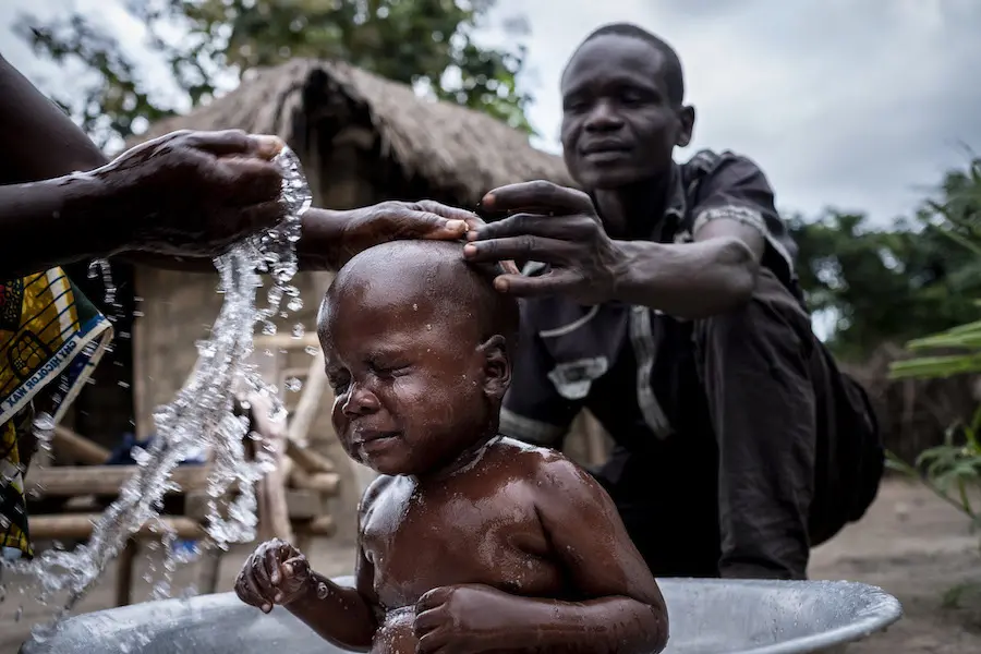 Pierre, 3, from the Central African Republic, recovered from a case of severe acute malnutrition (SAM) with support from UNICEF. Pierre, 3, from the Central African Republic, recovered from a case of severe acute malnutrition (SAM) with support from UNICEF.
