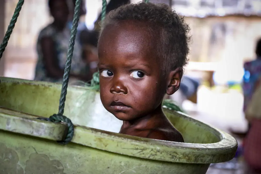 Pierre, 3, weighed only 19 pounds when his father took him to the UNICEF-supported malnutrition stabilization center at Bangui Pediatric Hospital in the Central African Republic. UNICEF, Central African Republic, children in conflict