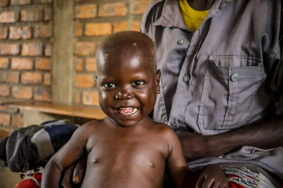 On his diet of RUTF, Pierre grew stronger by the day. Finally, after 10 days, Pierre was able to leave the UNICEF-supported hospital and continue his treatment as an outpatient at the health center near his village where his odyssey began. On his diet of RUTF, Pierre grew stronger by the day. Finally, after 10 days, Pierre was able to leave the UNICEF-supported hospital and continue his treatment as an outpatient at the health center near his village where his odyssey began.