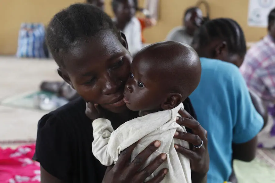 Mary, 24, brought 9-month-old Garang to be treated for malnutrition at UNICEF-supported Al Sabah Children's Hospital in Juba, South Sudan in November 2018. Mary, 24, brought 9-month-old Garang to be treated for malnutrition at UNICEF-supported Al Sabah Children's Hospital in Juba, South Sudan in November 2018.