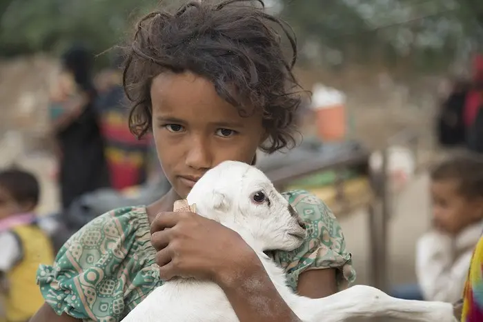  * Violence and malnutrition threaten millions children in Yemen like Saba, who is severely malnourished with complications, including fever and diarrhea. Saba’s parents and siblings are vulnerable to malnutrition because the family has lost its income