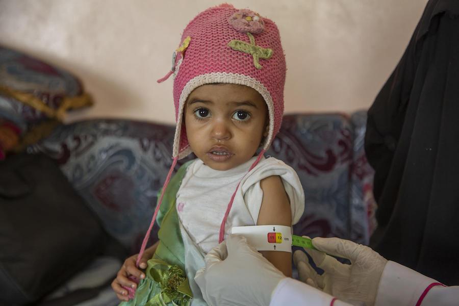 A UNICEF-supported community health worker checks a baby's mid-upper arm circumference to see if she is malnourished in Yemen's Hajjah Governate in March 2019.