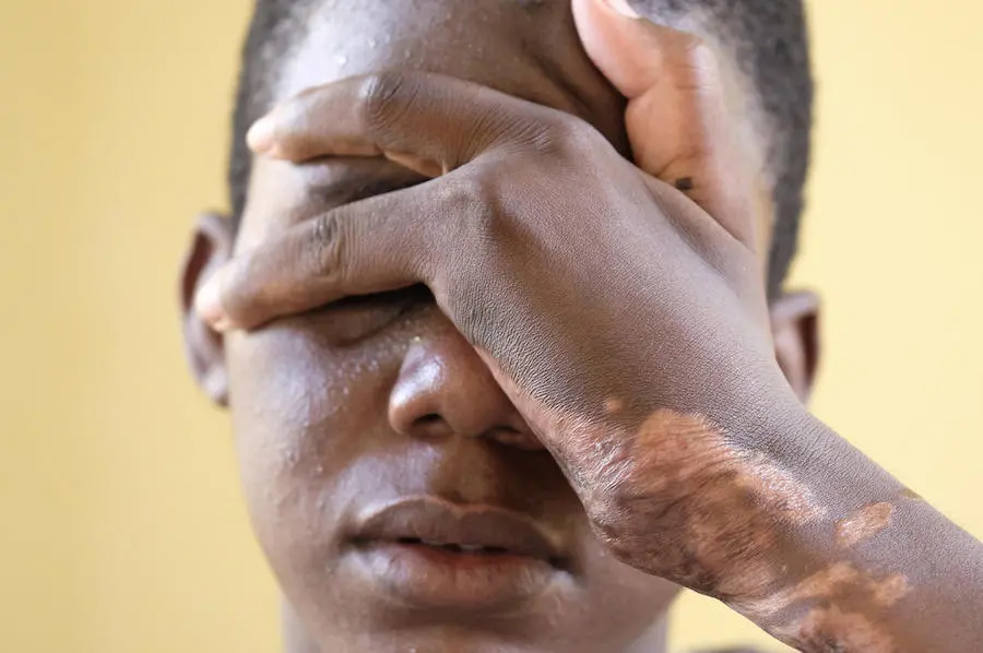 Sala was badly injured by militia in Mali. He is now safe at a center supported by UNICEF and NGO partners in Gao, Mali. Sala was badly injured by militia in Mali. He is now safe at a center supported by UNICEF and NGO partners in Gao, Mali.